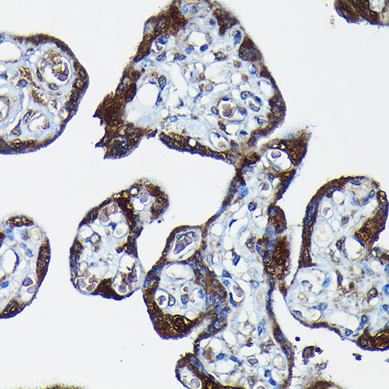 PEG10 Rabbit polyclonal antibody