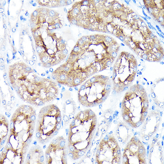 PEG10 Rabbit polyclonal antibody