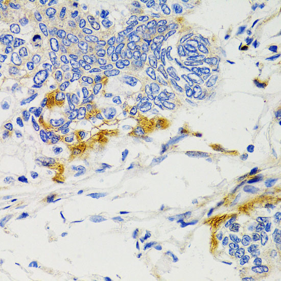SHP2 Rabbit polyclonal antibody