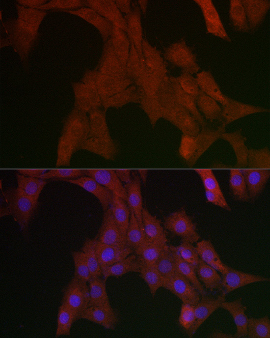 SHP2 Rabbit polyclonal antibody