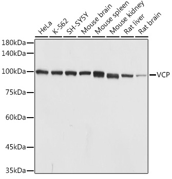 VCP Rabbit polyclonal antibody