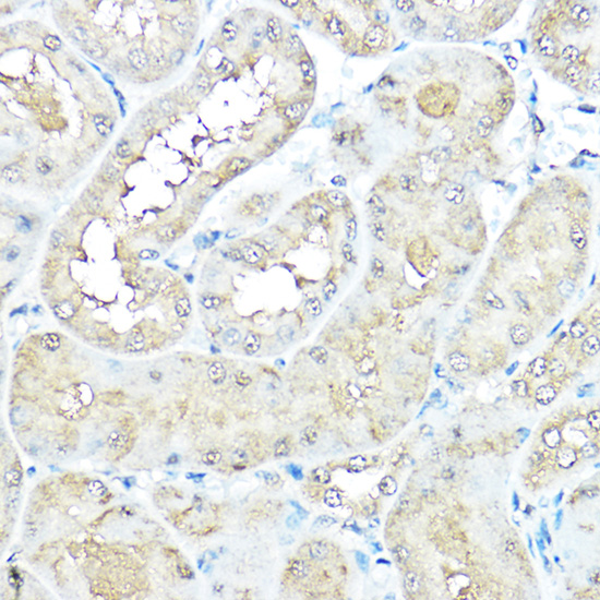 VCP Rabbit polyclonal antibody