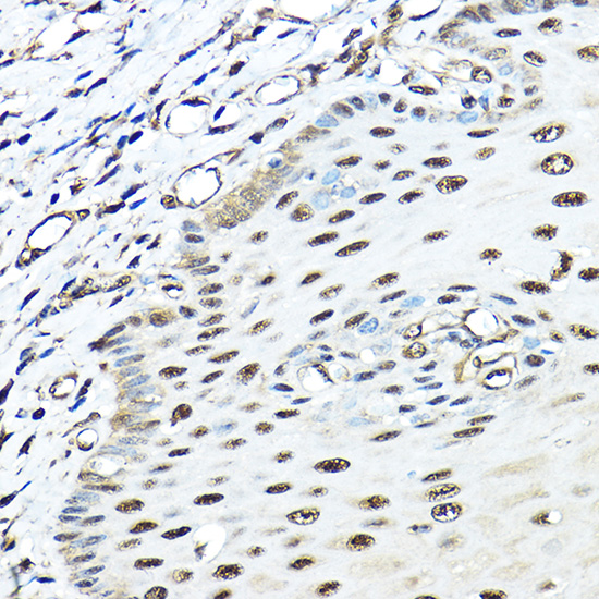 VCP Rabbit polyclonal antibody