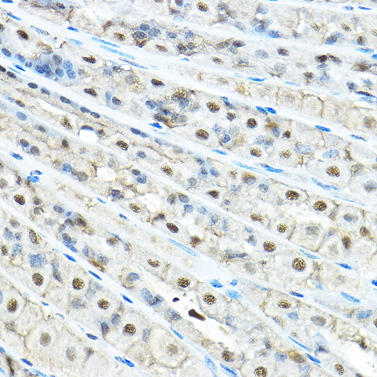 VCP Rabbit polyclonal antibody