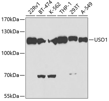 USO1 Rabbit polyclonal antibody