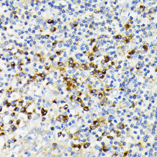 USO1 Rabbit polyclonal antibody