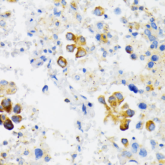 USO1 Rabbit polyclonal antibody