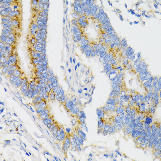 USO1 Rabbit polyclonal antibody