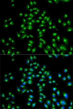 USO1 Rabbit polyclonal antibody