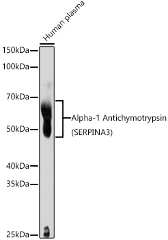 Alpha-1 Antichymotrypsin (SERPINA3) Rabbit polyclonal antibody
