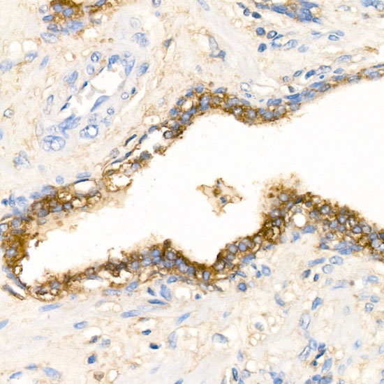 Alpha-1 Antichymotrypsin (SERPINA3) Rabbit polyclonal antibody