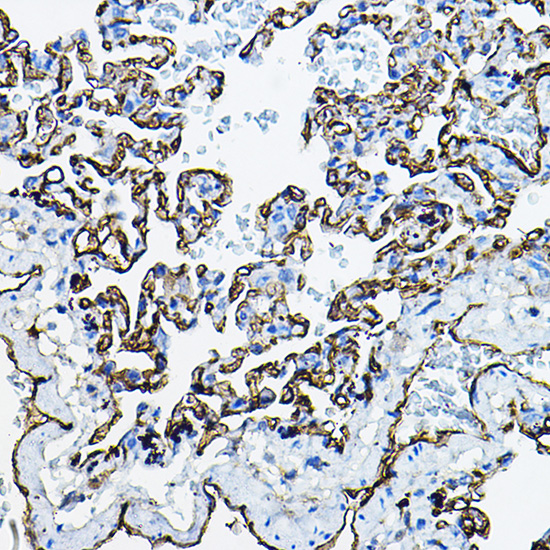 ACE1 Rabbit polyclonal antibody