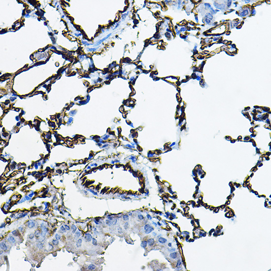 ACE1 Rabbit polyclonal antibody