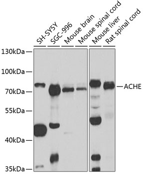 ACHE Rabbit polyclonal antibody
