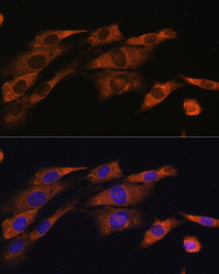 ACHE Rabbit polyclonal antibody