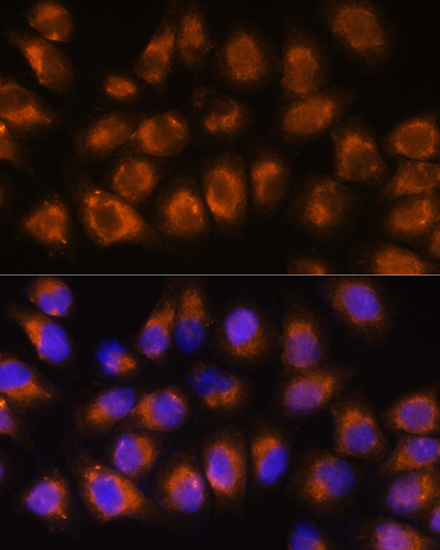 ACHE Rabbit polyclonal antibody