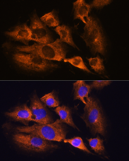 ACHE Rabbit polyclonal antibody