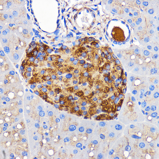 IAPP Rabbit polyclonal antibody