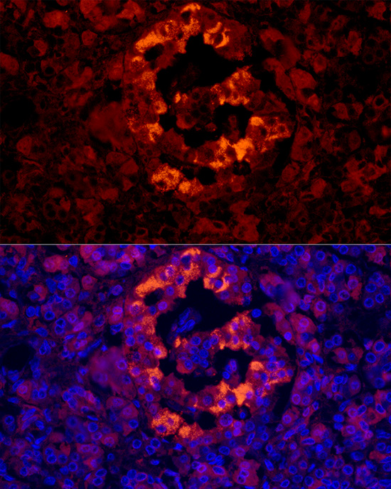 IAPP Rabbit polyclonal antibody