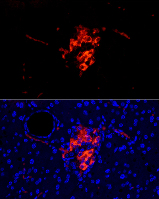 IAPP Rabbit polyclonal antibody