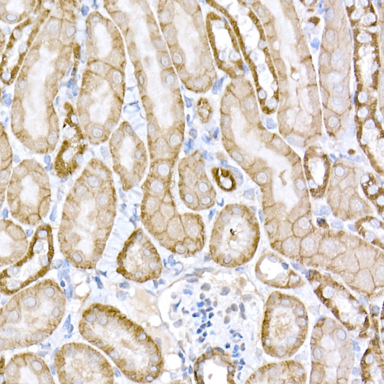 APC Rabbit polyclonal antibody