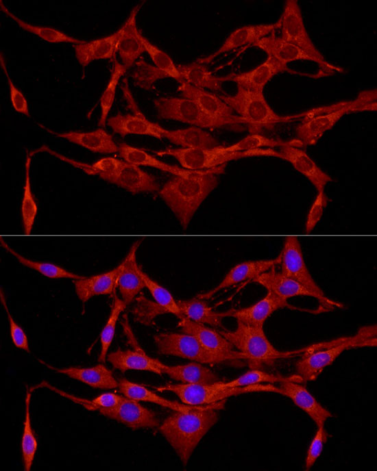 APC Rabbit polyclonal antibody