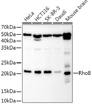 RhoB Rabbit polyclonal antibody