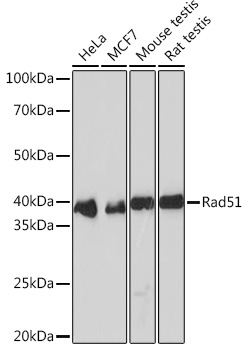 Rad51 Rabbit monoclonal antibody