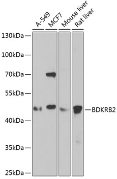 BDKRB2 Rabbit polyclonal antibody