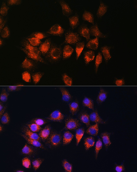 BDKRB2 Rabbit polyclonal antibody