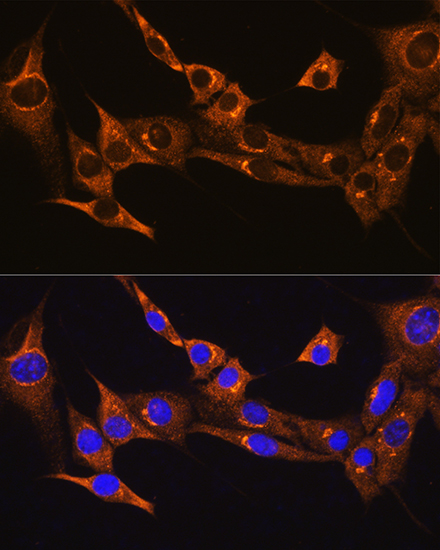 BDKRB2 Rabbit polyclonal antibody