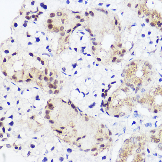 RUNX2 Rabbit polyclonal antibody