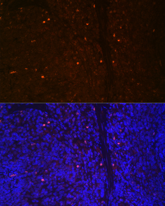 RUNX2 Rabbit polyclonal antibody