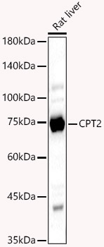 CPT2 Rabbit polyclonal antibody
