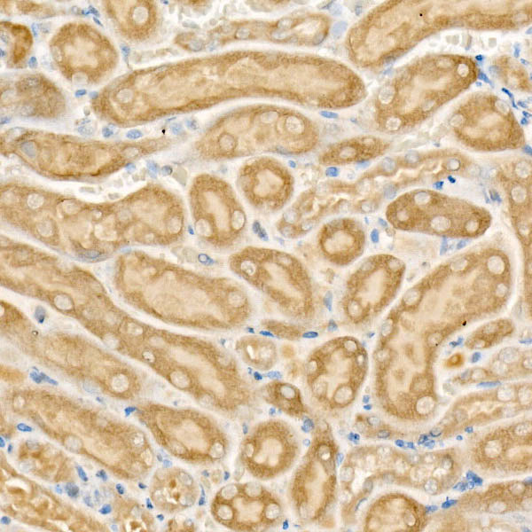 CPT2 Rabbit polyclonal antibody