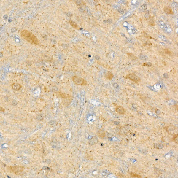 CPT2 Rabbit polyclonal antibody