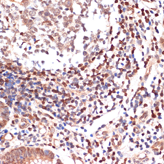 ALOX5 Rabbit monoclonal antibody