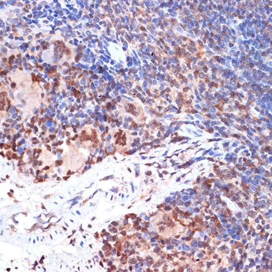 ALOX5 Rabbit monoclonal antibody