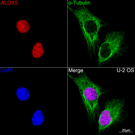 ALOX5 Rabbit monoclonal antibody