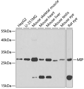 MIP Rabbit polyclonal antibody