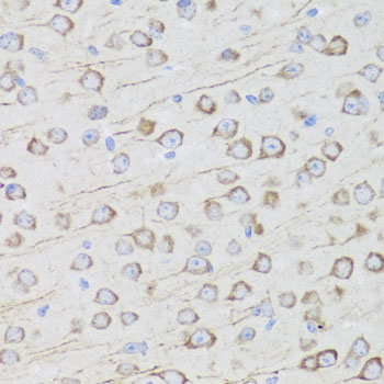 MIP Rabbit polyclonal antibody