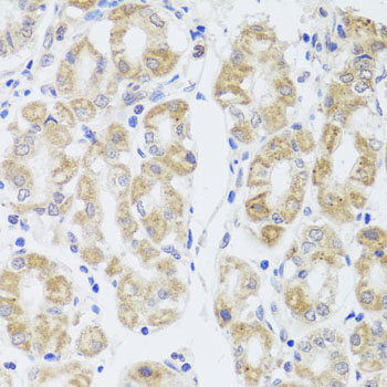 MIP Rabbit polyclonal antibody