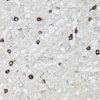 MIP Rabbit polyclonal antibody