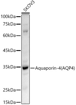 Aquaporin-4 (AQP4) Rabbit polyclonal antibody