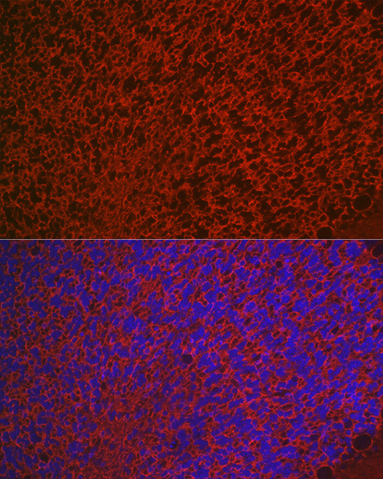 Aquaporin-4 (AQP4) Rabbit polyclonal antibody