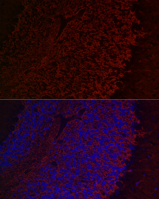 Aquaporin-4 (AQP4) Rabbit polyclonal antibody