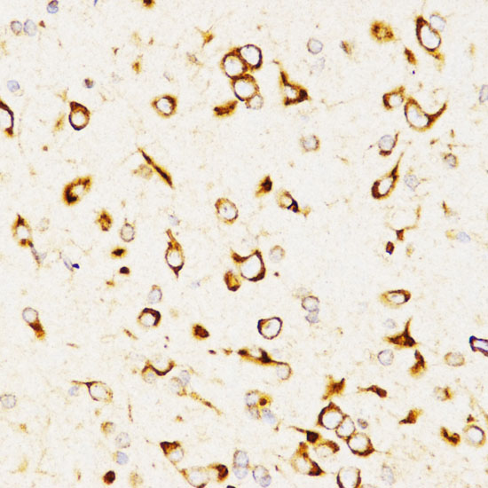 LAMP3 Rabbit polyclonal antibody