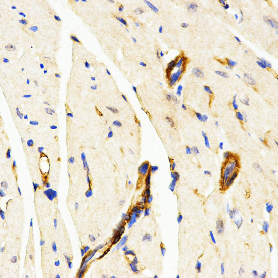 LAMP3 Rabbit polyclonal antibody