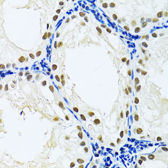 DDB1 Rabbit polyclonal antibody