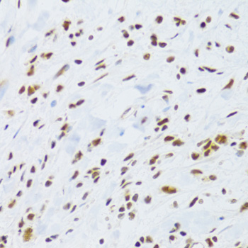 DDB1 Rabbit polyclonal antibody